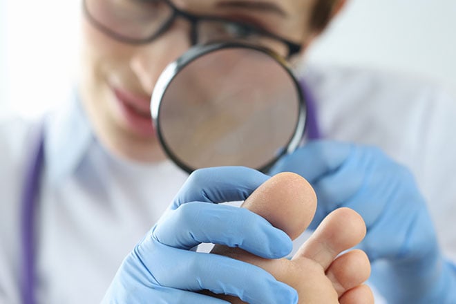 How to Fix Ingrown Toenails