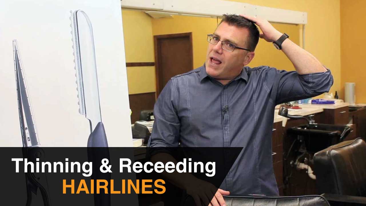 Thinning and Receding Hairlines